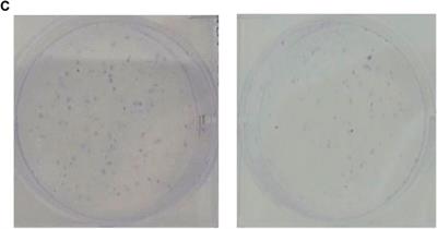 Corrigendum: Comprehensive transcriptomic analysis of critical RNA regulation associated with metabolism and prognosis in clear cell renal carcinoma